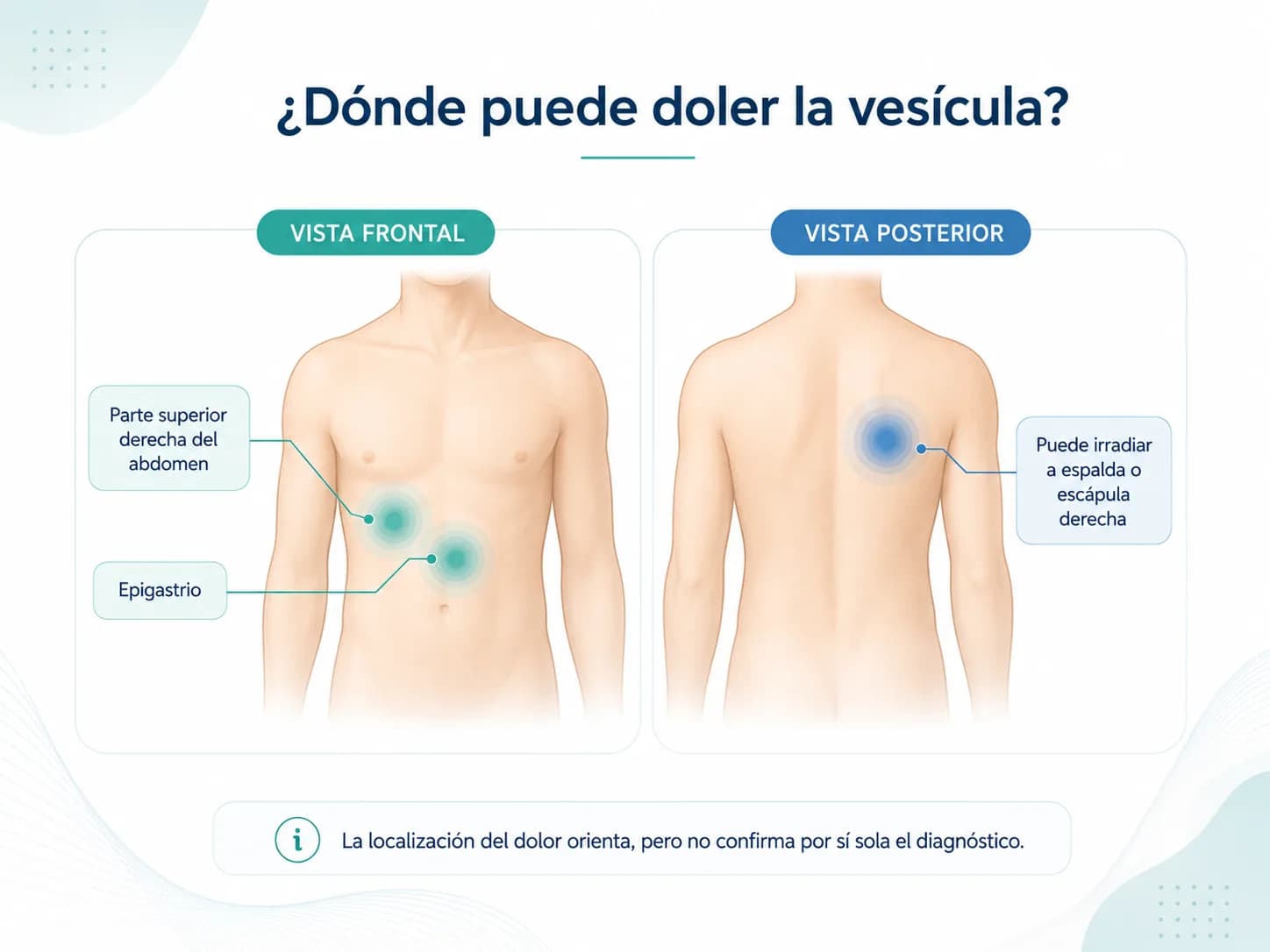 Zonas orientativas del dolor biliar en abdomen superior y espalda